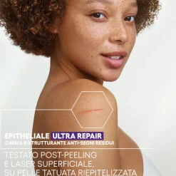 Aderma Epitheliale Ultra Ha+ Crema Riparatrice Anti Segni 100ml