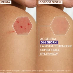 Aderma Epitheliale Ultra Ha+ Crema Riparatrice Anti Segni 100ml