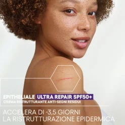 A-Derma Epitheliale Ultra HA+ Crema Ristrutturante Anti Segni con SPF50+ 40ml