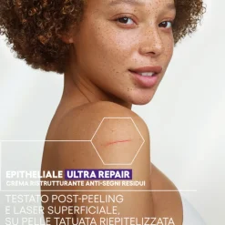 Aderma Epitheliale Ultra Repair Crema Ristrutturante Anti Segni per Riparazione Cutanea 40ml