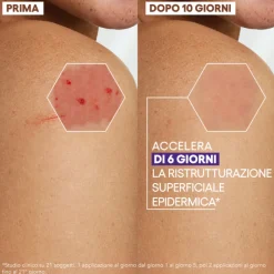 Aderma Epitheliale Ultra Repair Crema Ristrutturante Anti Segni per Riparazione Cutanea 40ml