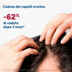 Ducray Neoptide Expert Siero Anticaduta Capelli Donna 100ml