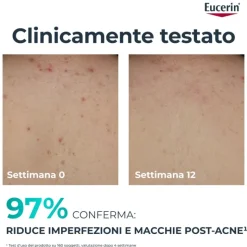 Eucerin Dermopure Crema Corpo Tripla Azione Acido Salicilico per Macchie 200ml