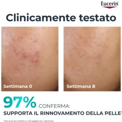 Eucerin Dermopure Peeling 10 Trattamento Rinnovatore Notturno per Imperfezioni 40ml