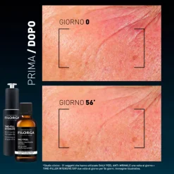 Filorga Daily Peel Wrinkles Soluzione Rinnovatrice Anti-rughe per Viso 50 ml