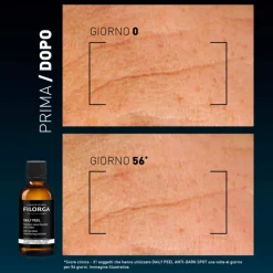 Filorga Daily Peel Wrinkles Soluzione Rinnovatrice Anti-rughe per Viso 50 ml
