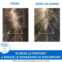 Uriage Ds Hair Shampoo antiforfora per cuoio capelluto sensibile 200ml